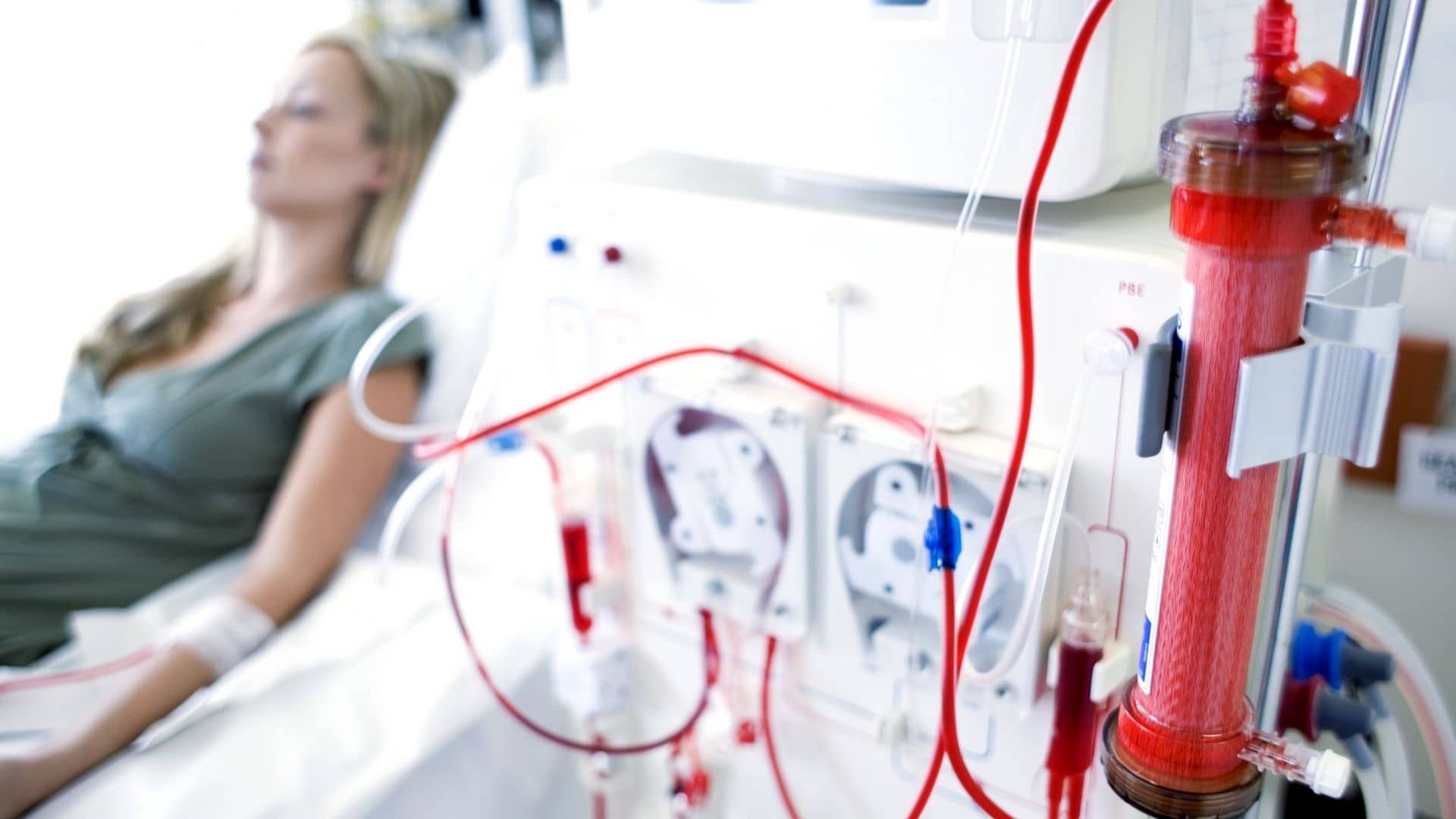 Kidney disease - leading cause of death 10 Kidney disease leads to dialysis.