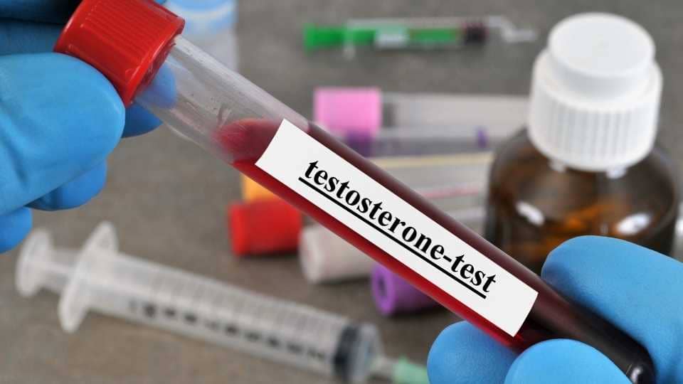 Testosterone Blood Test Testosterone Blood Test