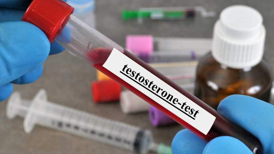 Testosterone Blood Test Testosterone Blood Test
